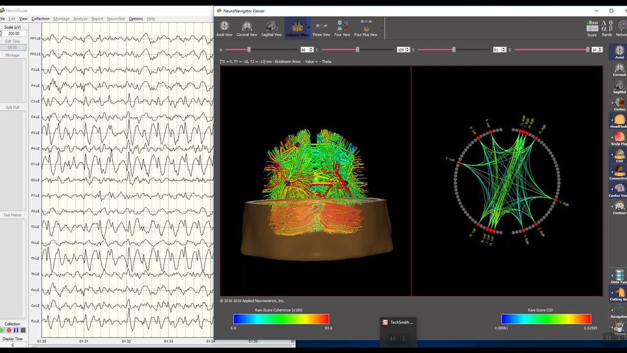 NeuroGuide NeuroNavigator Connectome in Real-Time