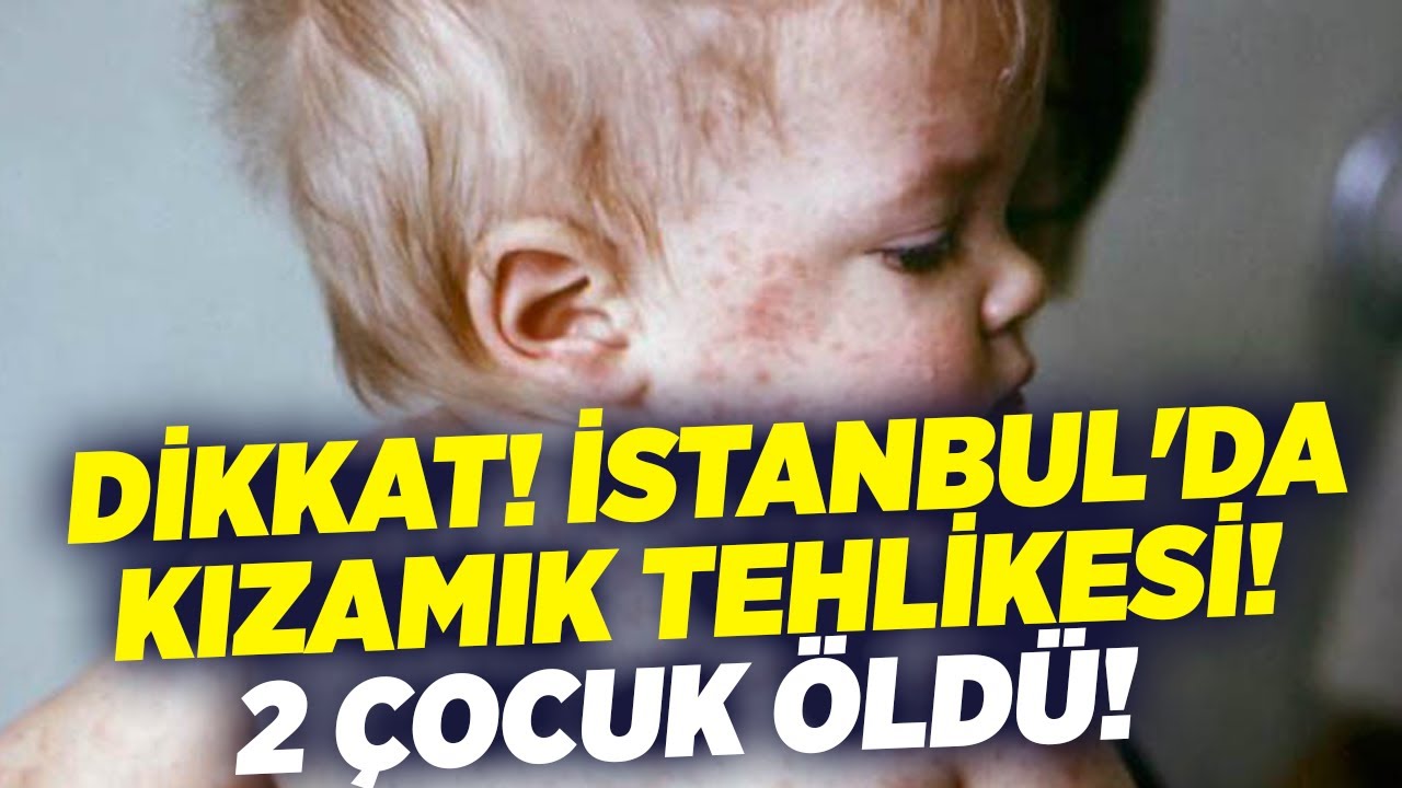 DİKKAT! İstanbul'da Kızamık Tehlikesi! 2 Çocuk Öldü! Bir Hastane de ise... | Mehmet Ceyhan KRT Haber