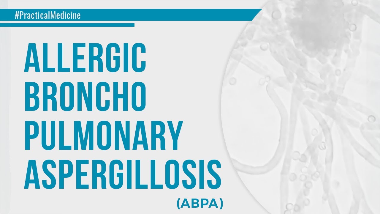 Allergic Broncho-Pulmonary Aspergillosis (ABPA)