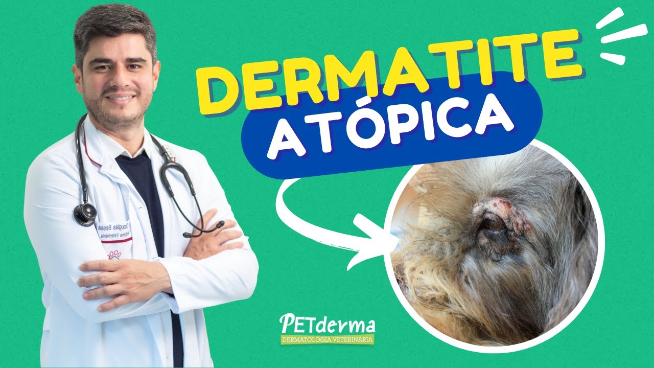 O que é Dermatite Atópica?
