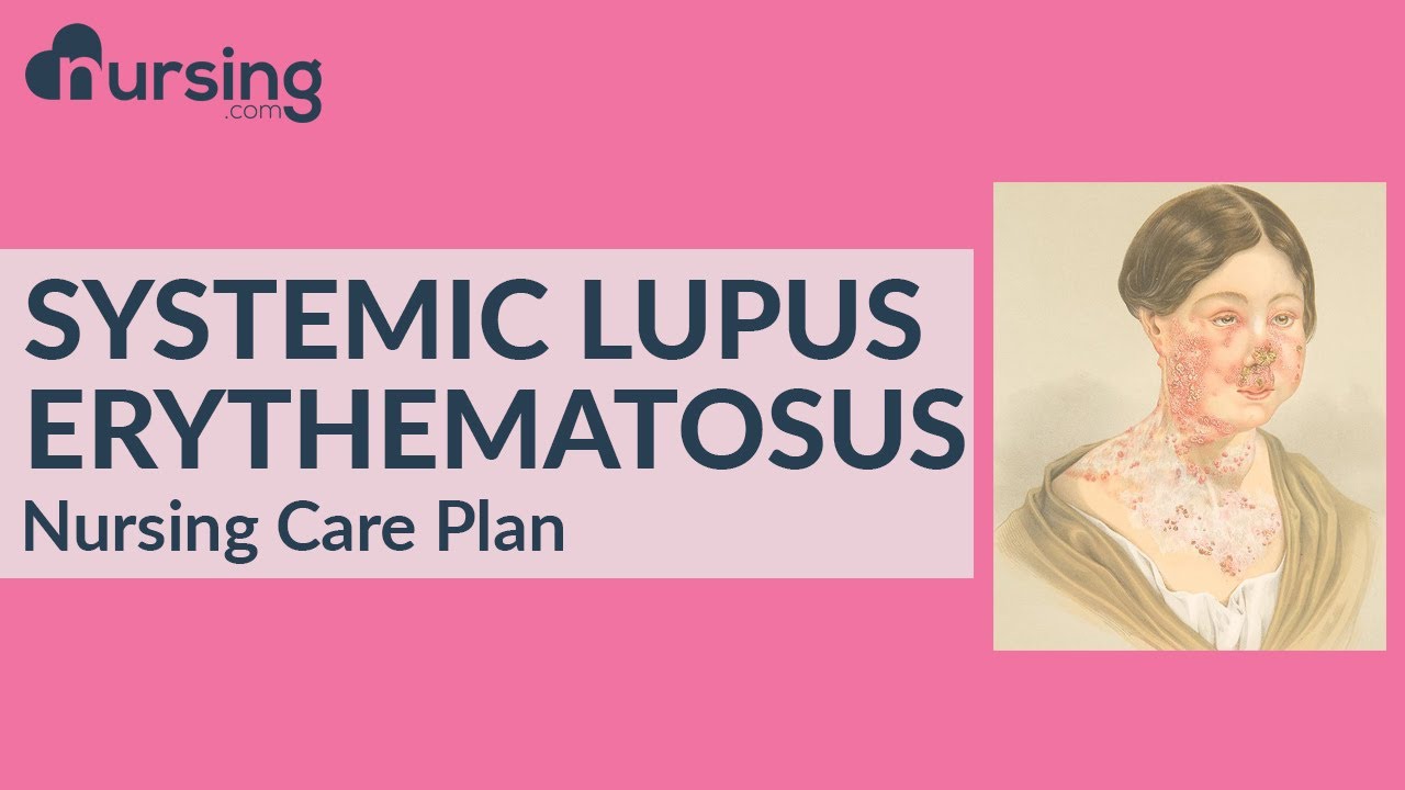 Nursing Care Plan for Systemic Lupus Erythematosus (Nursing Care Plan)