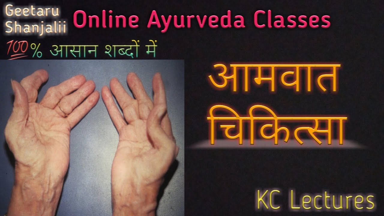 आमवात चिकित्सा आयुर्वेद में by Geetaru