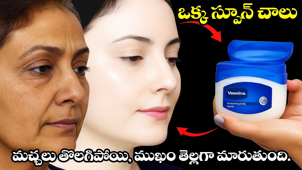 Vaseline తో ఇలా చేస్తే ఎంత డార్క్ స్కిన్ అయినా గ్లో వచ్చేస్తుంది 🌟మచ్చలు, డార్క్ ప్యాచెస్ మాయం🌿