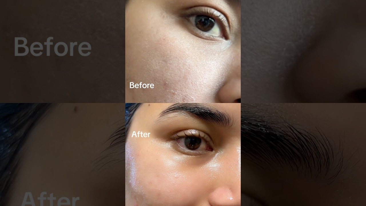 This little ingredient can change your skin✅✨ #celimax#retinal#koreanskincare#retinol #clearskin