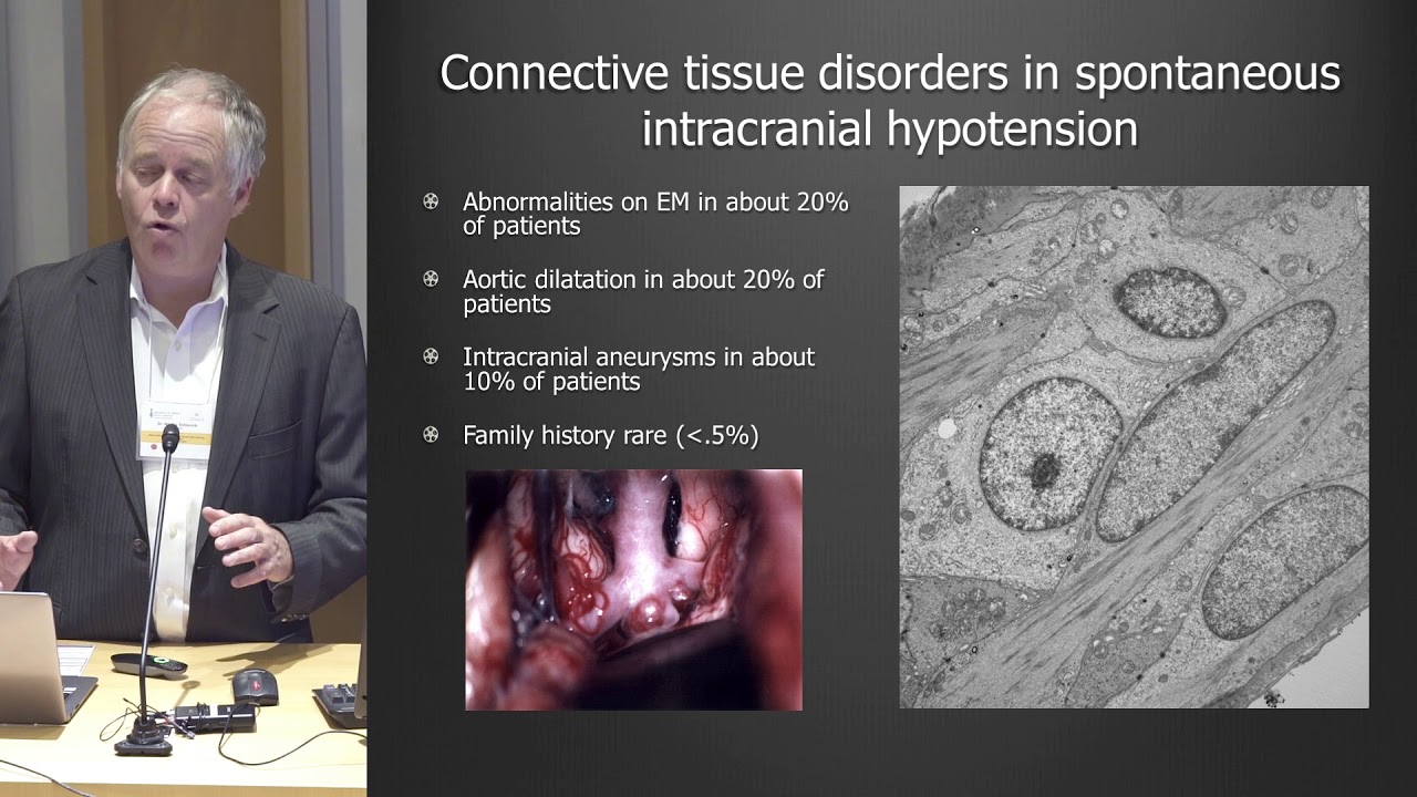 Dr. Wouter I. Schievink, MD, Neurosurgery: The Differential Diagnosis of Headaches in EDS