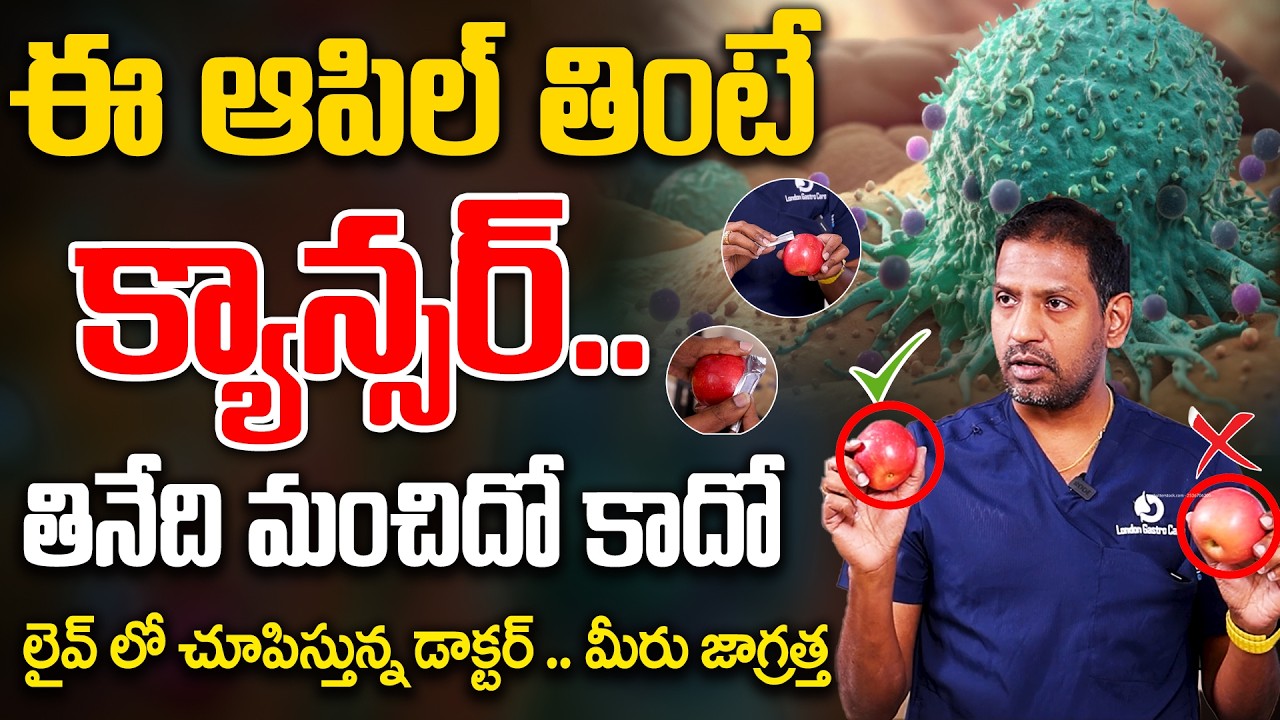 Dr Chandra Puli - ఈ ఆపిల్ తినడం వల్లే క్యాన్సర్ వచ్చింది..మీరు జాగ్రత్త | Apple Cancer | Sumantv