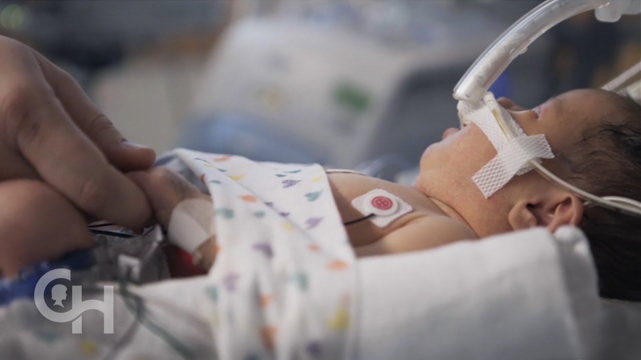 Congenital Diaphragmatic Hernia Repair: Lillian Jane’s CDH Story, Prenatal Diagnosis to Home