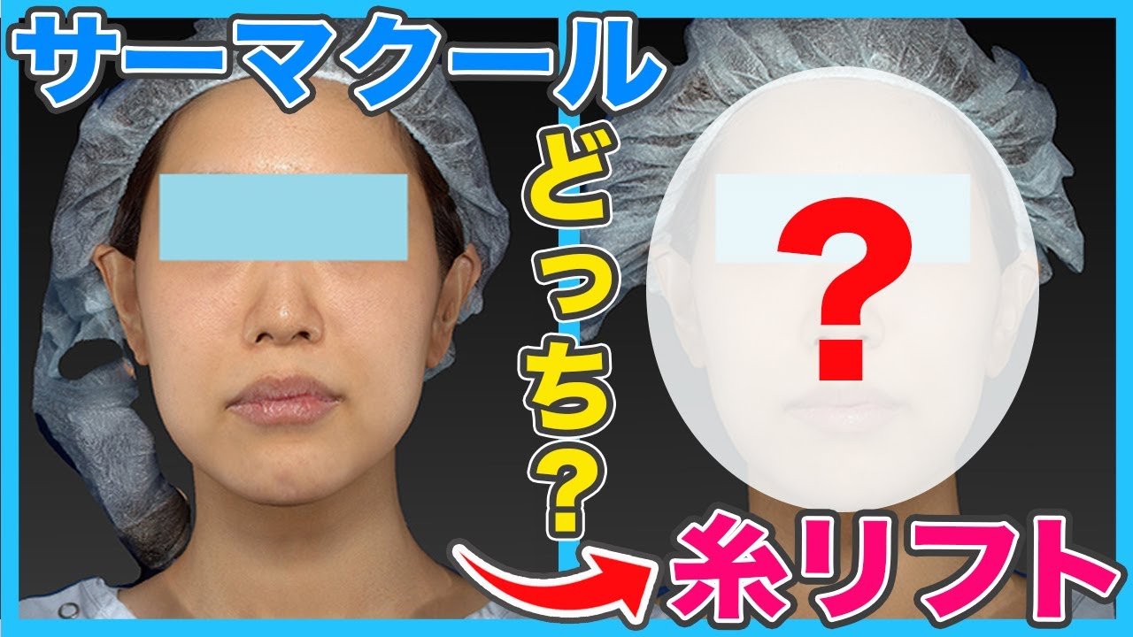 【たるみ治療】糸リフトとサーマクールのどちらを選ぶべき？