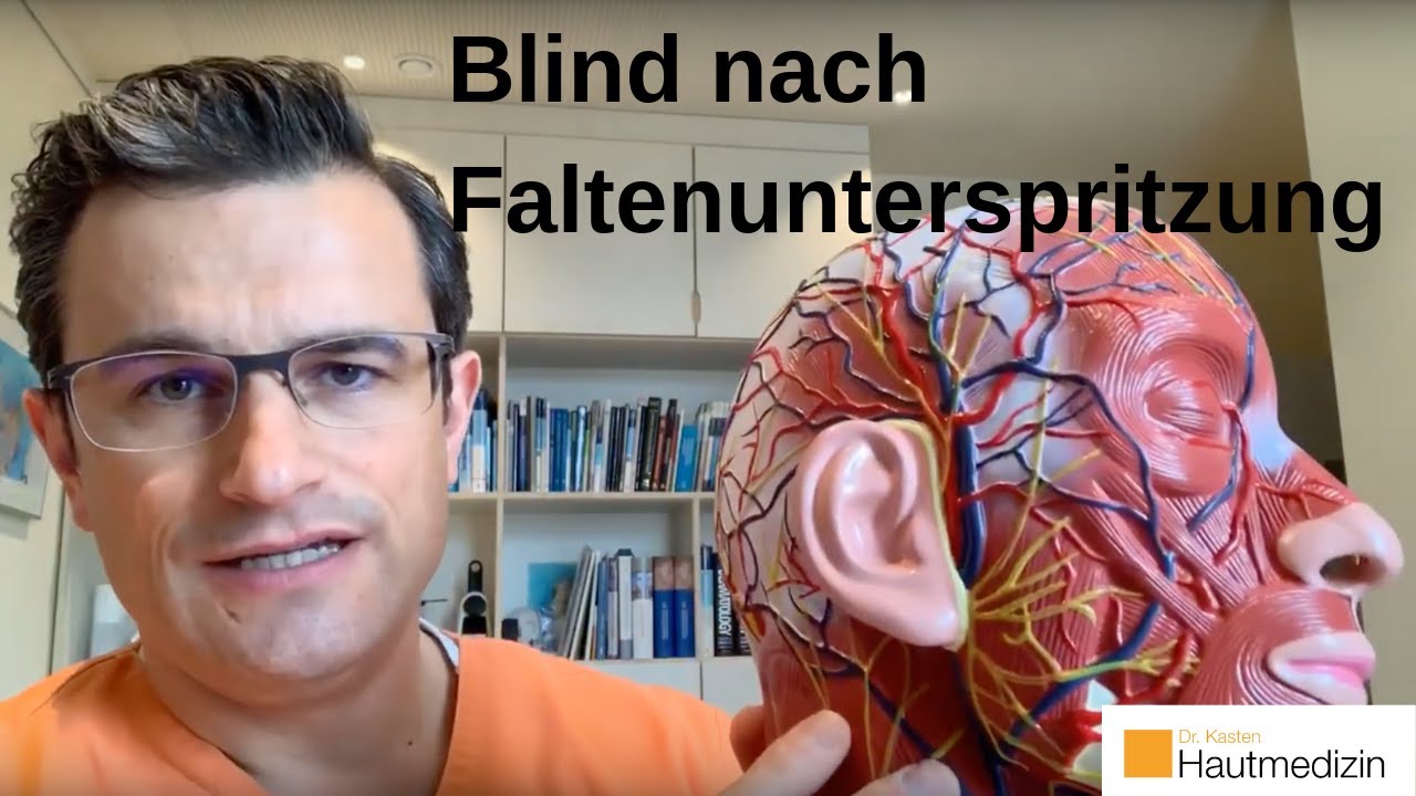 BLIND NACH FALTENBEHANDLUNG