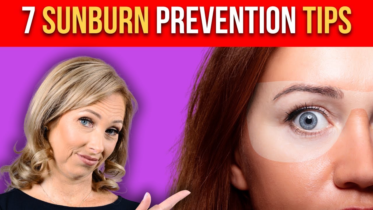 7 Sunburn Prevention Tips | Dr. Janine