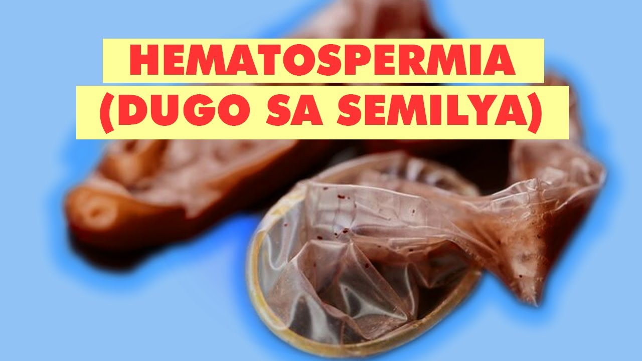 [Q&A] HEMATOSPERMIA O DUGO SA SEMILYA | FAQ