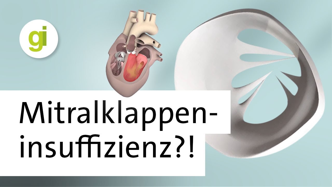 Undichte Herzklappe: Was ist eine Mitralklappeninsuffizienz?