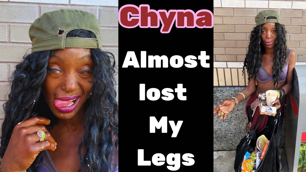 Homeless Addicted Prostitute - Chyna