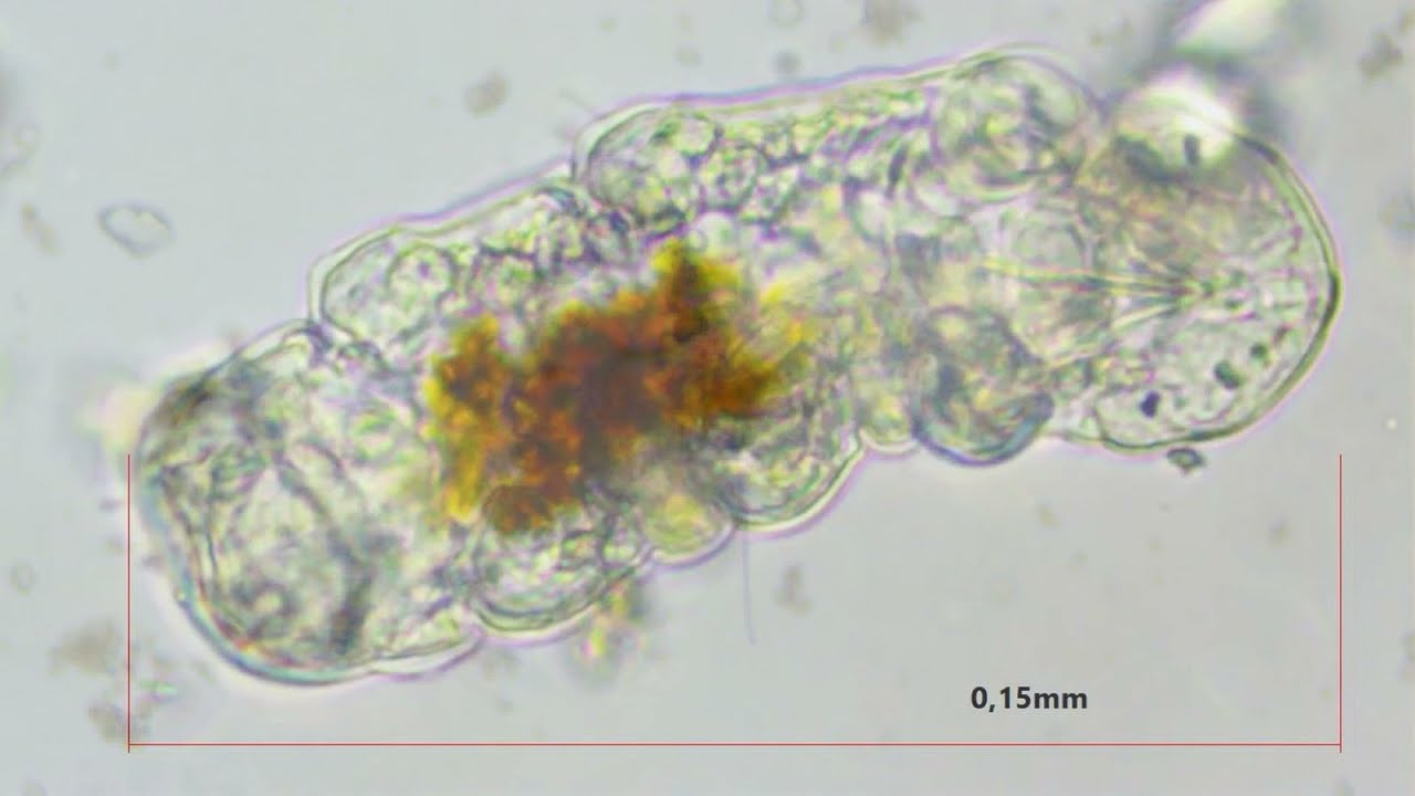 Niesporczak (Tardigrada)
