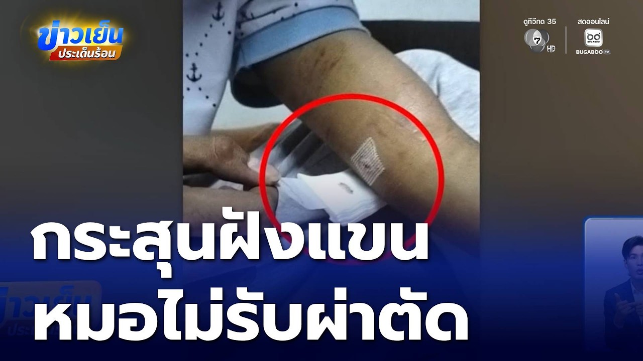 กระสุนฝังแขน หมอไม่รับผ่าตัด | ข่าวเย็นประเด็นร้อน