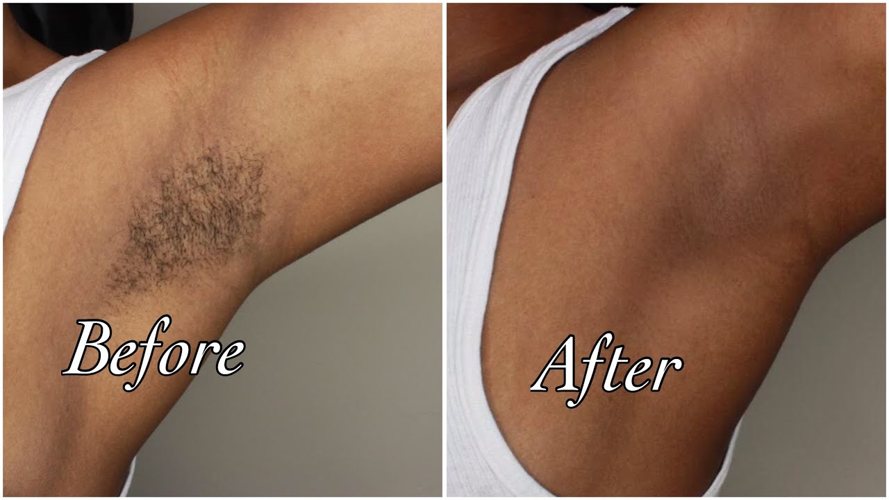 How I Wax My Own Armpits