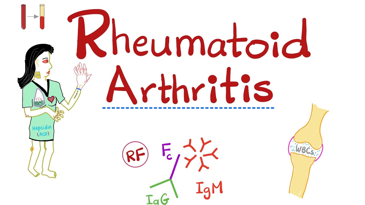 Rheumatoid Arthritis (RA) - Quick Review - Rheumatology Playlist
