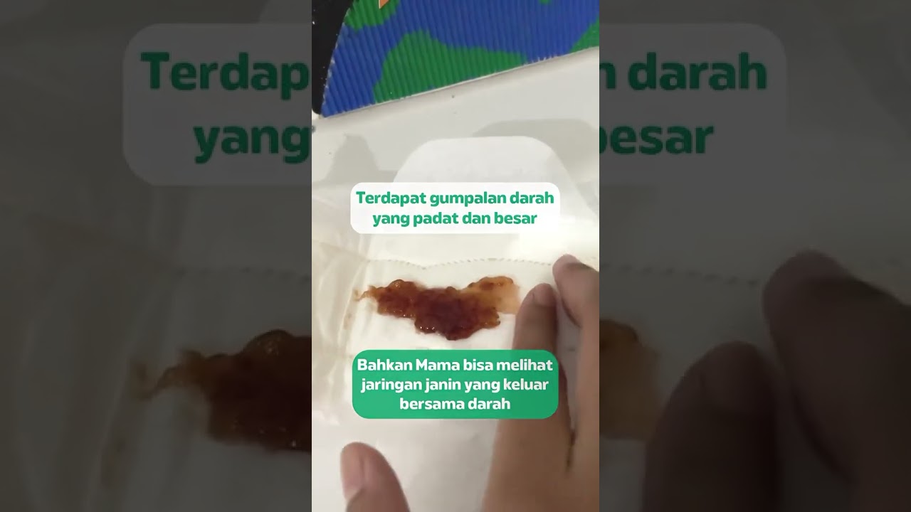 Ciri Darah Keguguran‼️