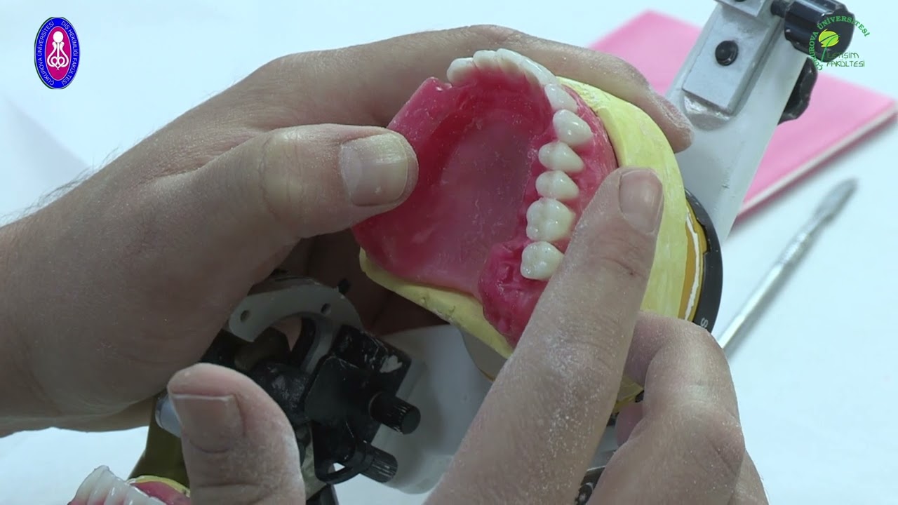 Prof. Dr. Yurdanur Uçar Total Protez Posterior Diş Dizimi (  Posterior Teeth Build-up )