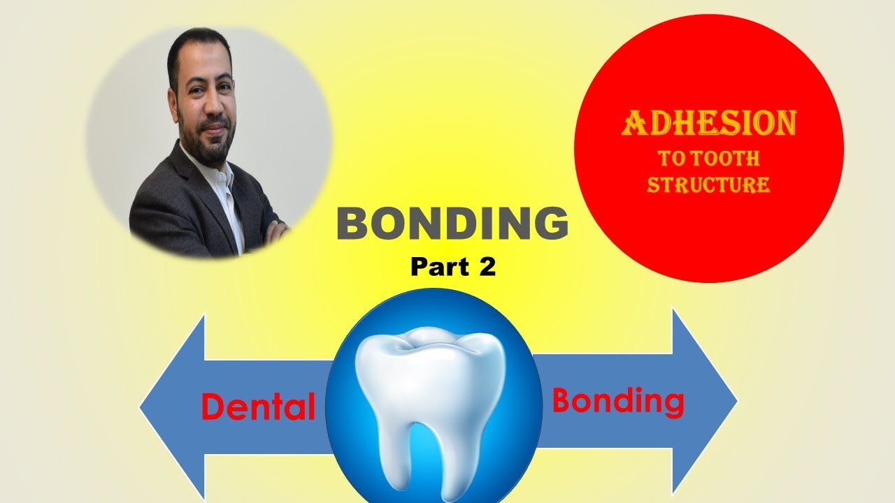 Adhesion to tooth structure (Bonding) part 2