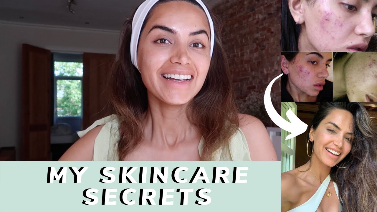 MY SKINCARE JOURNEY // PART 1