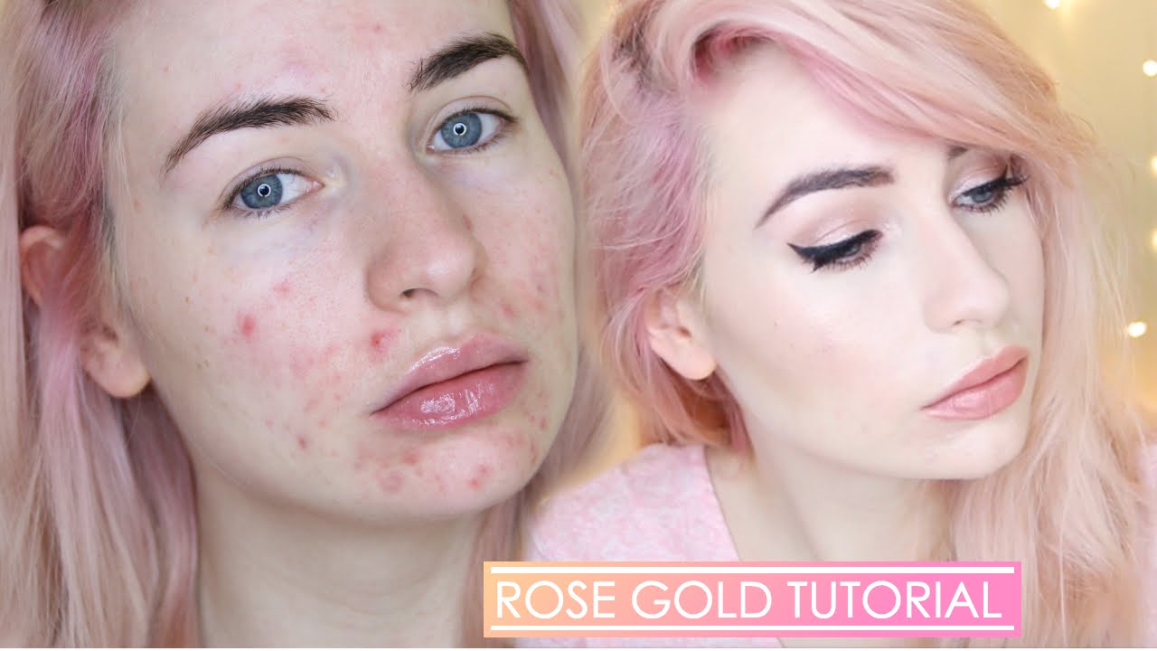 ROSE GOLD MAKEUP TUTORIAL | Full Face with acne