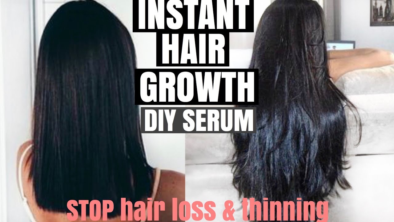 DIY HAIR GROWTH CURE | HOW TO GROW LONGER THICKER HAIR Naturally + Fast | Stop Hair Loss Instantly