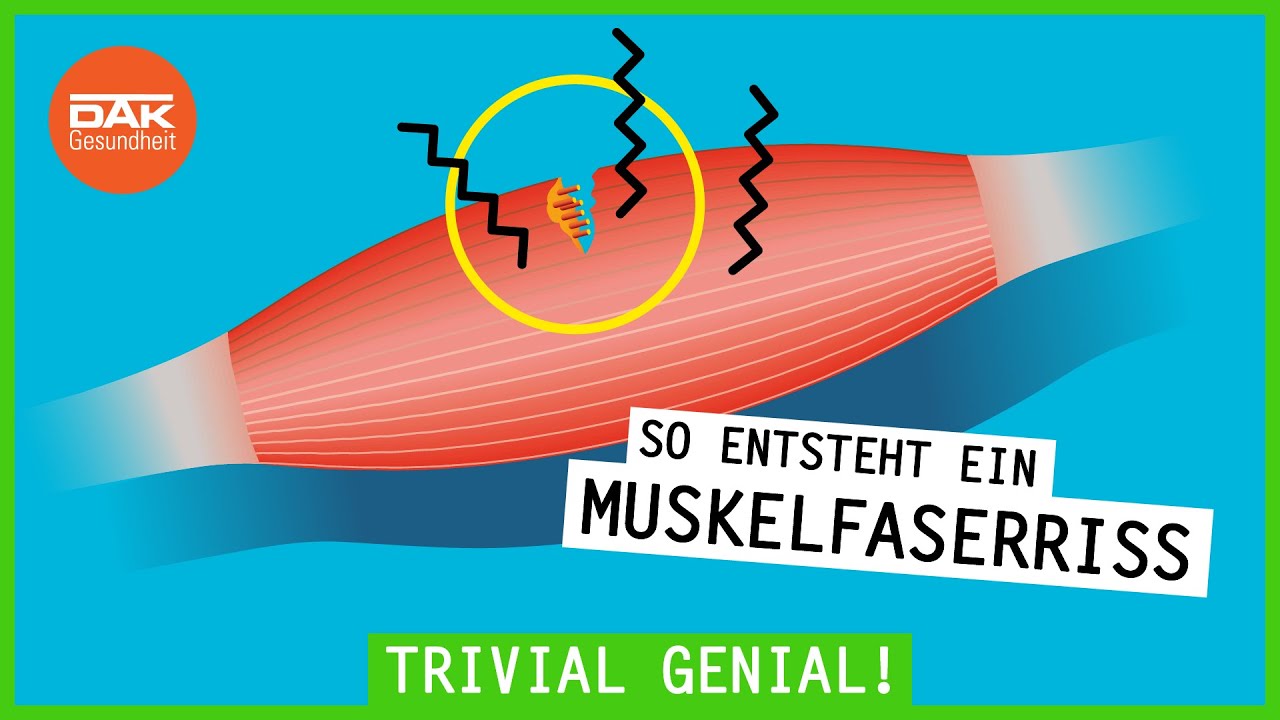 Wie entsteht ein Muskelfaserriss? | #trivialgenial | DAK-Gesundheit