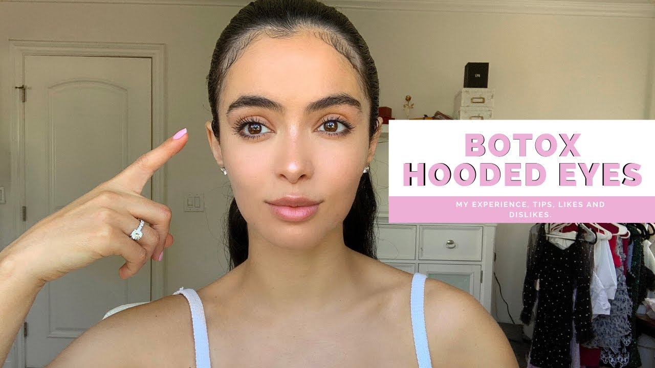 BOTOX- BEFORE AND AFTER - HOODED EYES- LIFT