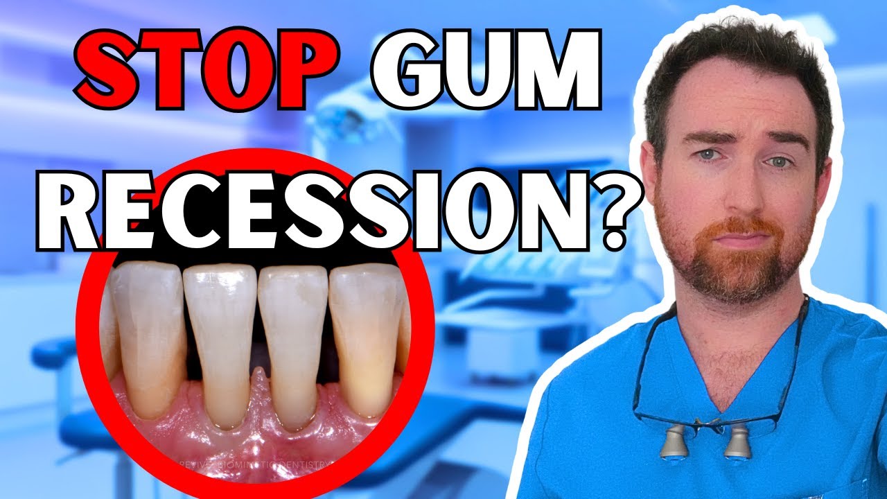 The #1 Best Remedy for Gum Recession