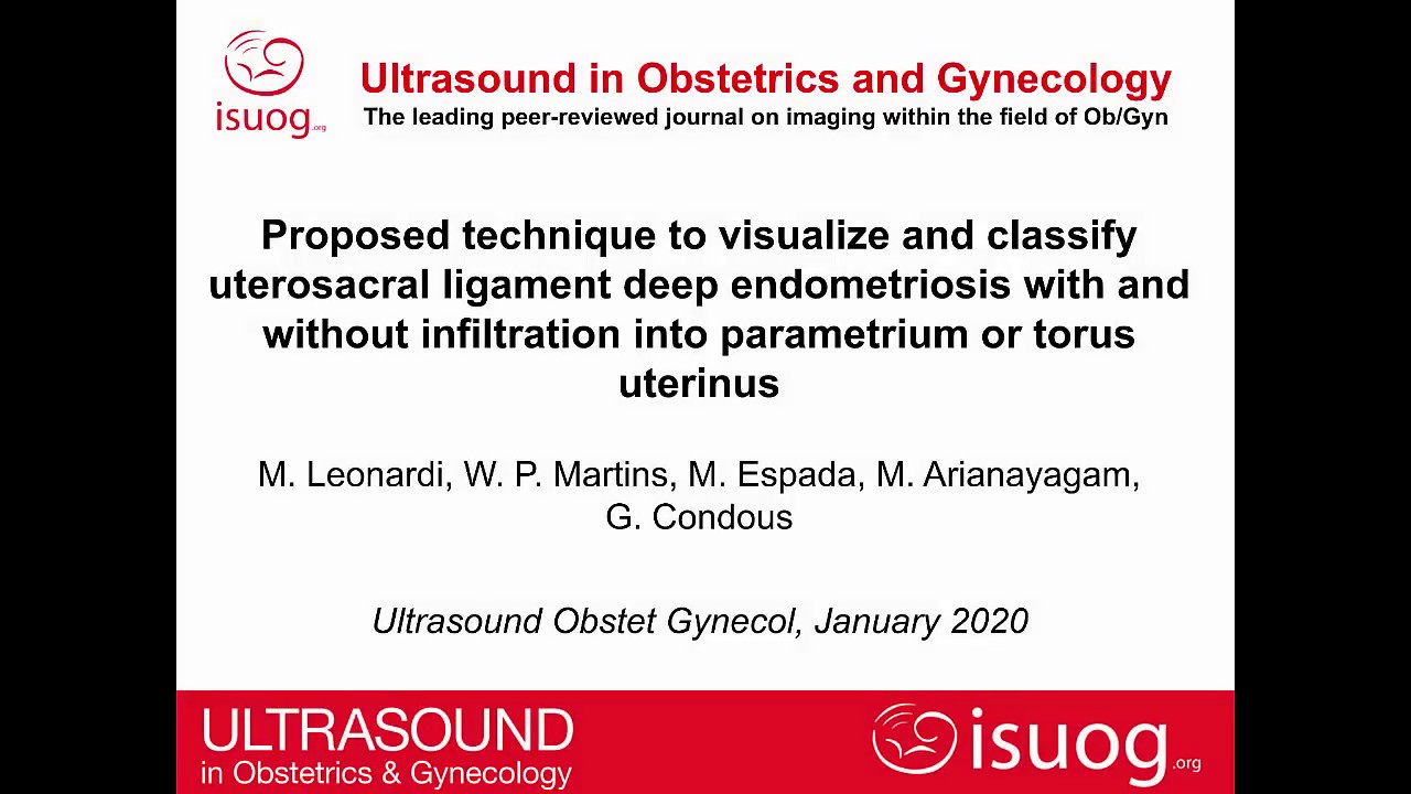 UOG video clip: Proposed technique to visualize and classify uterosacral ligament deep endometriosis