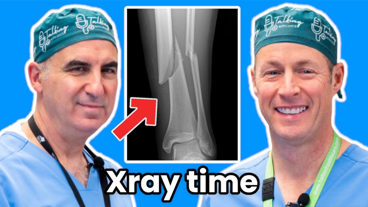 Injured Your Ankle. Do You Need An X-ray?  Here's How To Tell