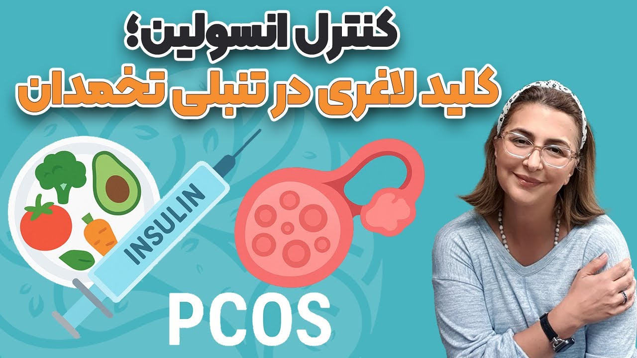 راه‌حل علمی برای کاهش وزن در تنبلی تخمدان پلی‌کیستیک