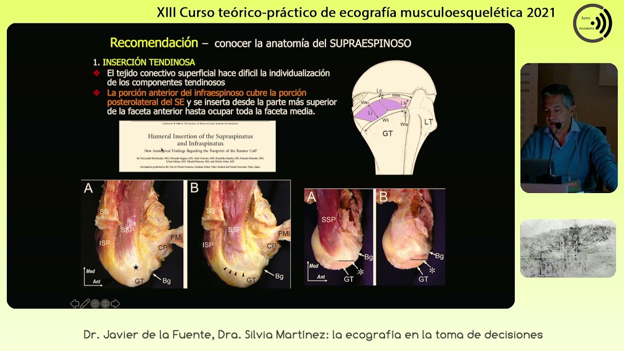 2021 Trucos y Recomendaciones para la exploración avanzada del hombro  Javier de la Fuente