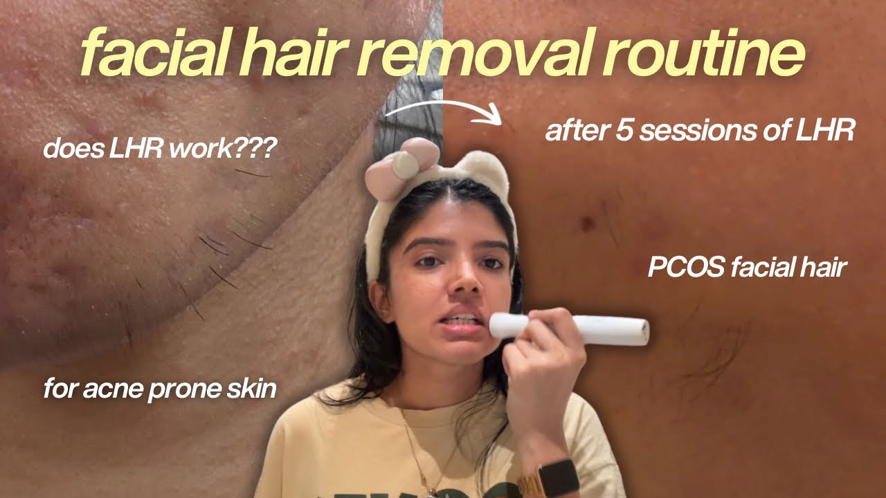 My Facial Hair Removal Routine for PCOS & Acne-Prone Skin