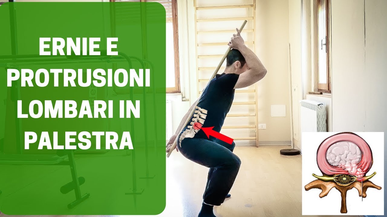 DISCOPATIE, PROTRUSIONI ed ERNIE LOMBARI in PALESTRA: come allenarsi e cosa NON fare