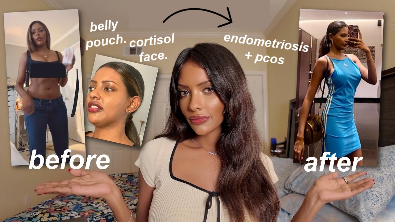 how I got my SUMMER body without Ozempic & you can too! ♡ lose face fat/ belly fat