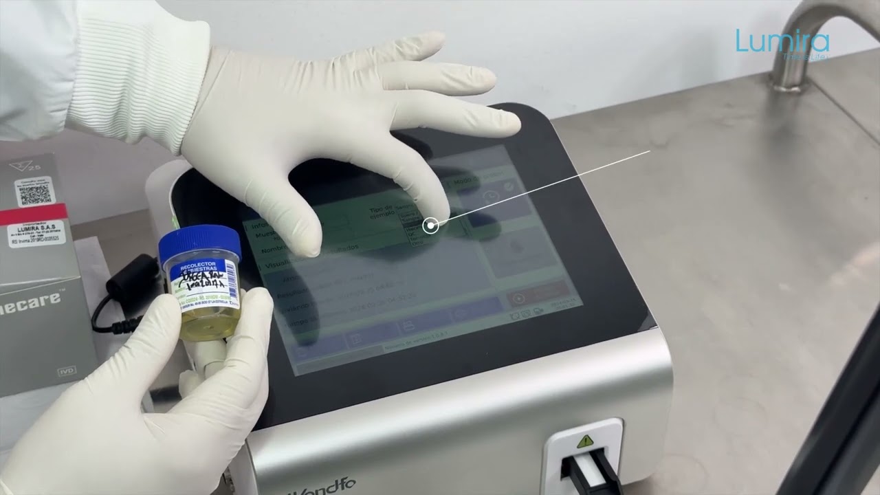 🧪 Montaje de Prueba de Microalbuminuria en Finecare | Paso a Paso