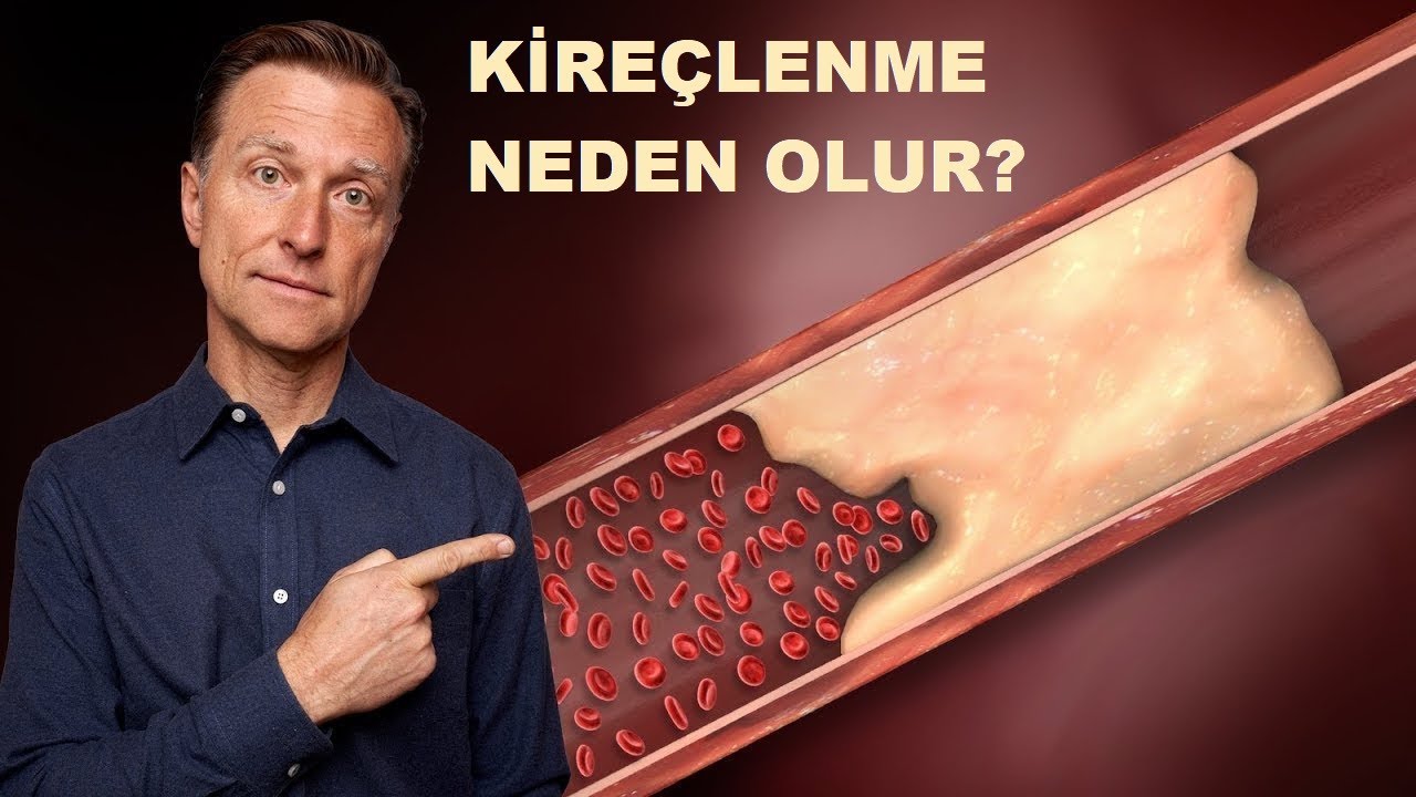 Damarlardaki Kireçlenmenin ve Kemik Dokusu Oluşmasının Gerçek Nedeni | Dr.Berg Türkçe