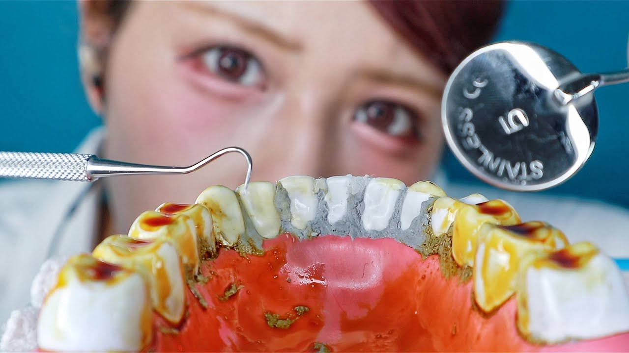【ASMR】あなたの歯石を除去します🦷/ ロールプレイング