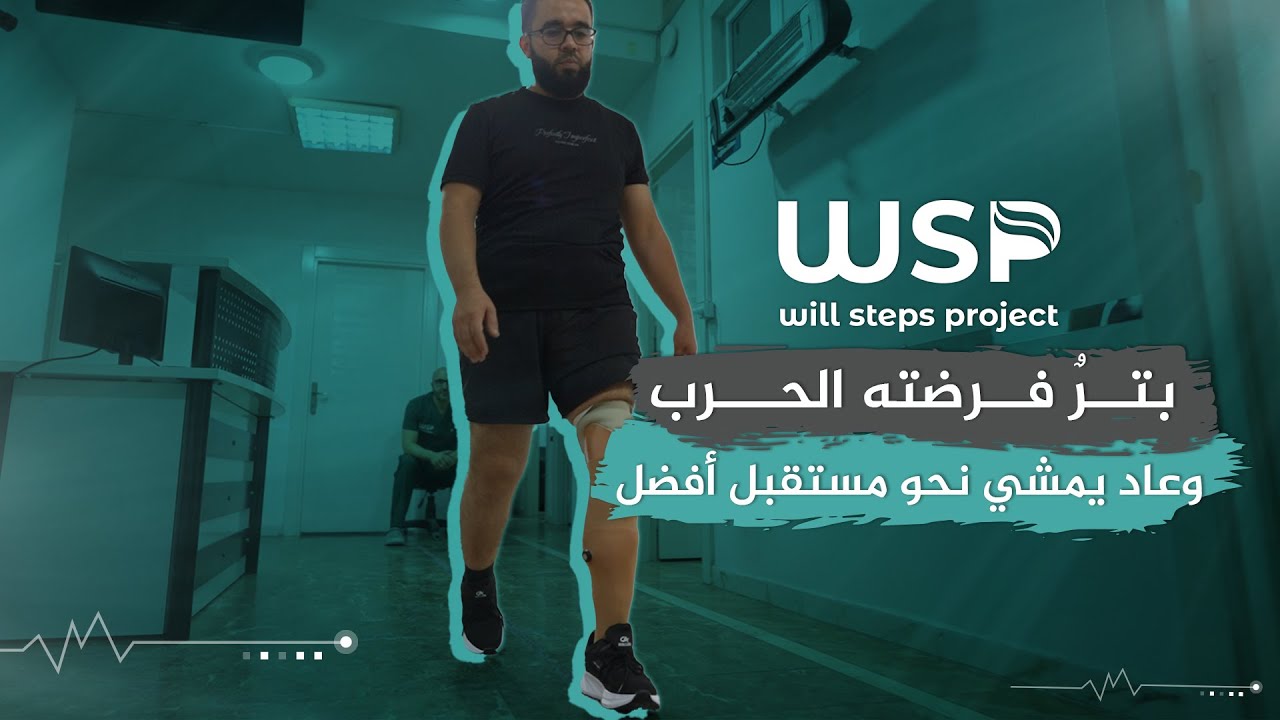 تركيب طرف صناعي لحالة بتر ساق #منظمة_خطوات_الإرادة #منظمات_انسانية #أطراف_صناعية #بتر_الأطراف
