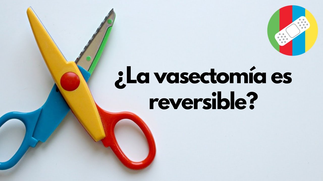 &iquest;La vasectom&iacute;a es reversible?