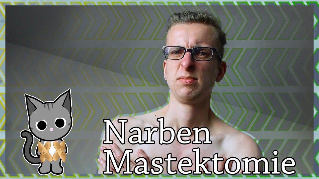 ²¹⋅¹⁰⋅²⁰¹⁸ Narben Spannungsgefühl & Verklebungen