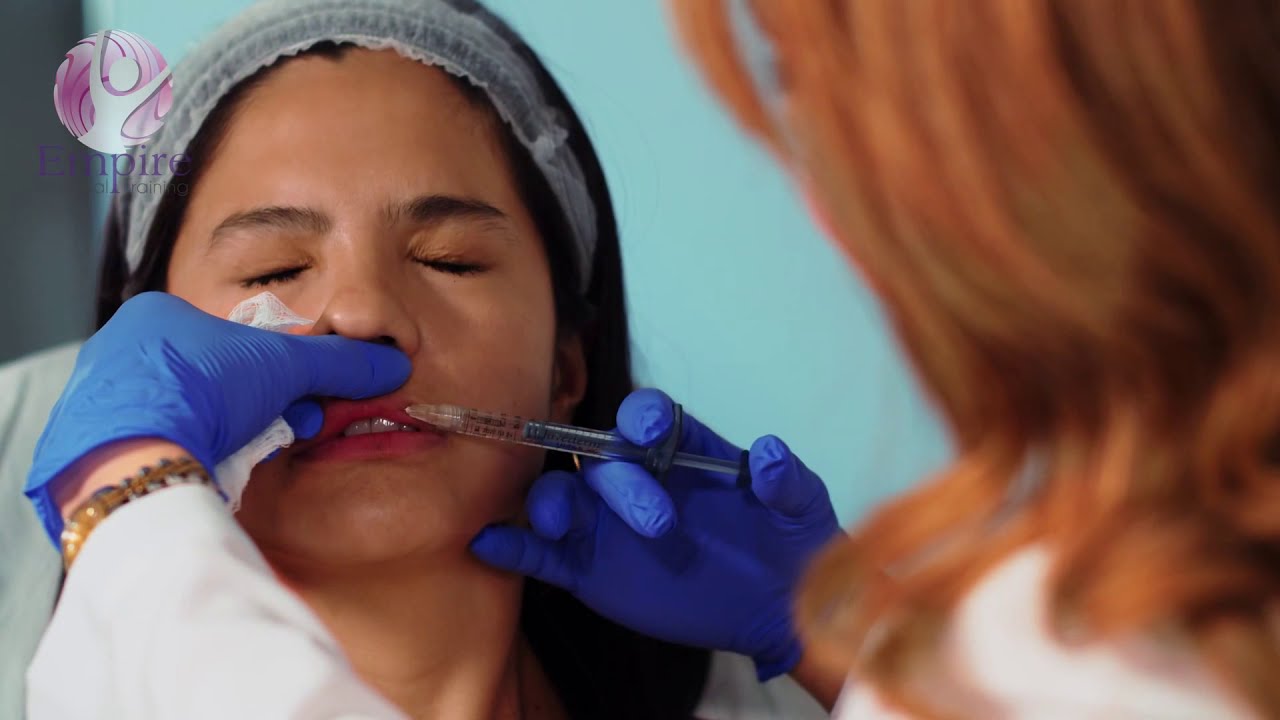 Lip Filler Testimonial: Getting Beautiful Results