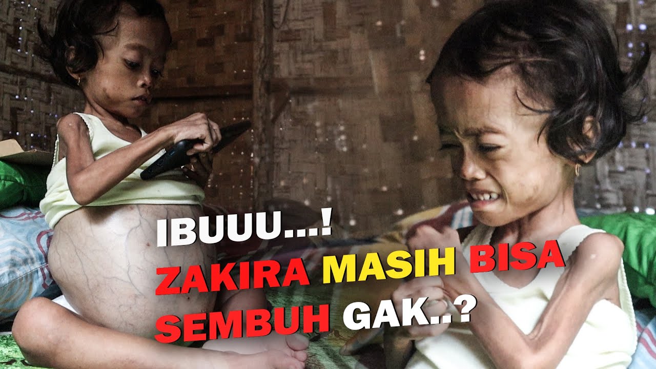 TANG1S DAN KONDISI ZAKIRA MEMBUAT HATI PILU‼️Fadli Putra Lampung