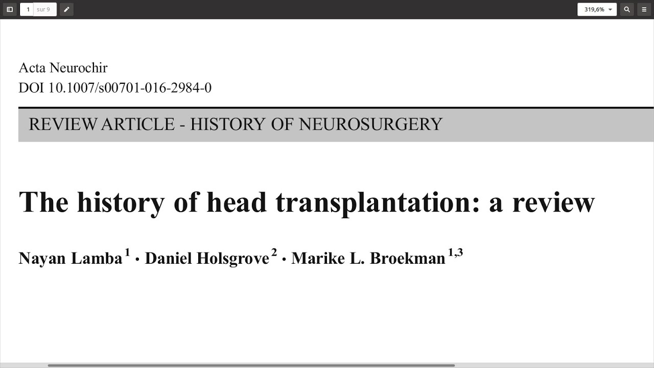 L'histoire de la transplantation de tête: une revue