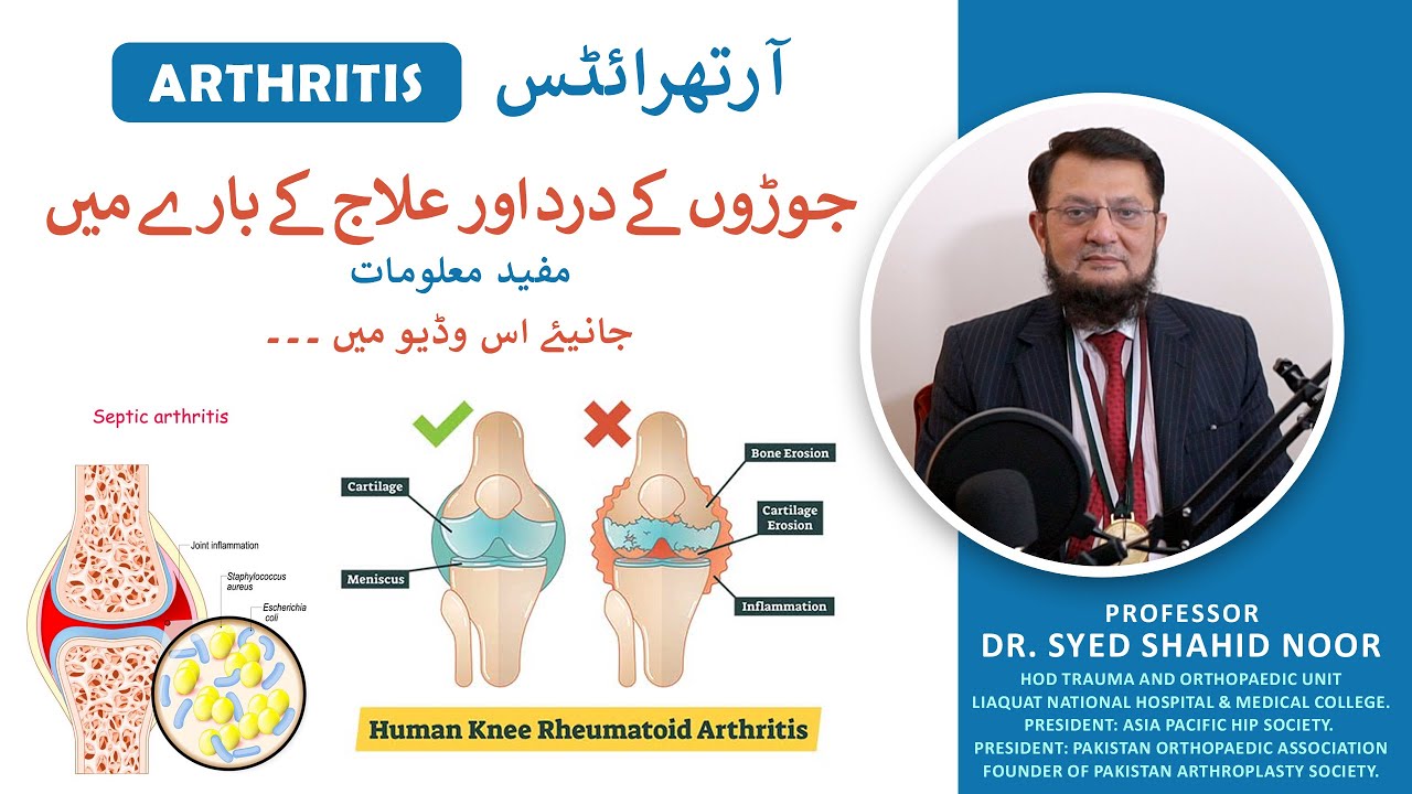 Prof. Dr. Syed Shahid Noor | Arthritis | Bone Health With Experts | Shaigan Pharma #ShaiganHealthTV