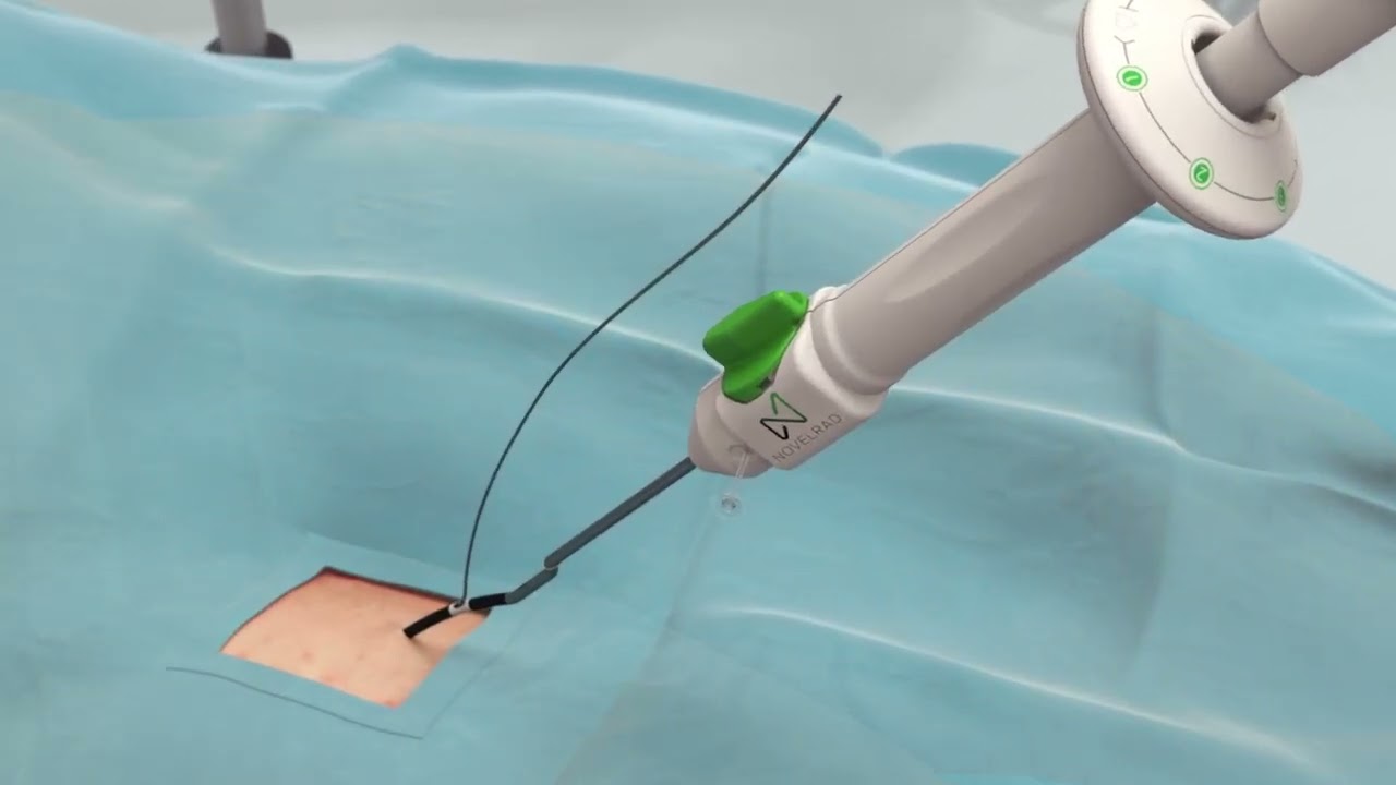 Novelrad by Mvr - Medical Animations