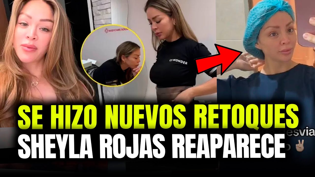 SHEYLA ROJAS SE HIZO NUEVOS ARREGLOS PARA REJUVENECER Y TONIFICAR SU FIGURA