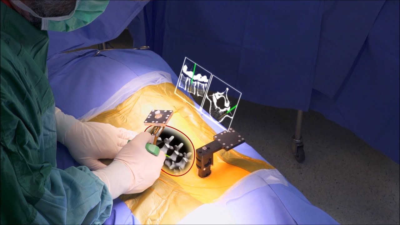 How an AR Surgery Headset Works | The Henry Ford’s Innovation Nation